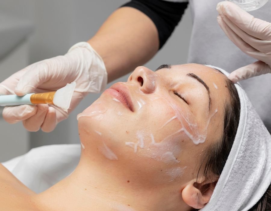 Spa_Luna-Creciente_Servicios_hiperpigmentacion