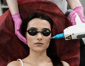 Spa_Luna-Creciente_Servicios_hiperpigmentacion2